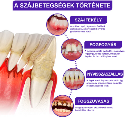 🌟Zubná pasta Rolimey® VioCore s včelím jedom