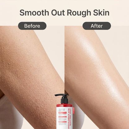 Časovo obmedzená 50% zľava 💧 Mierne kyslé exfoliačné telové mlieko na báze ryže, jemný zázrak na redukciu kožných príznakov pri keratóze pilaris 🍚