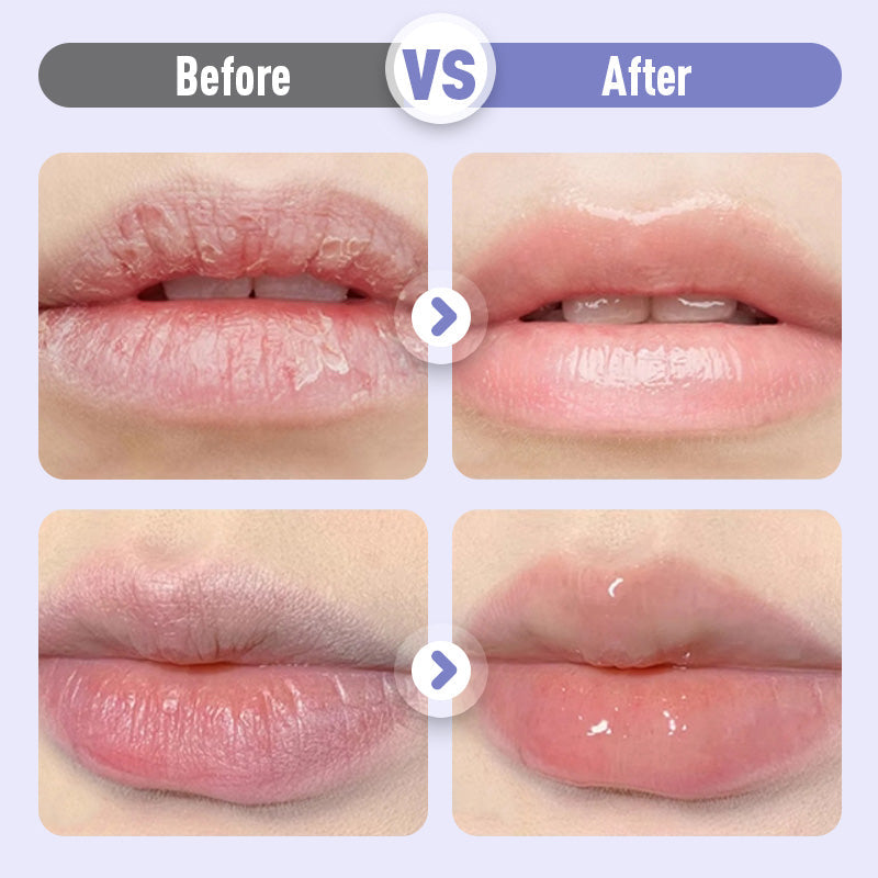 💕Zahusťujúce a vyhladzujúce hydratačné sérum na pery