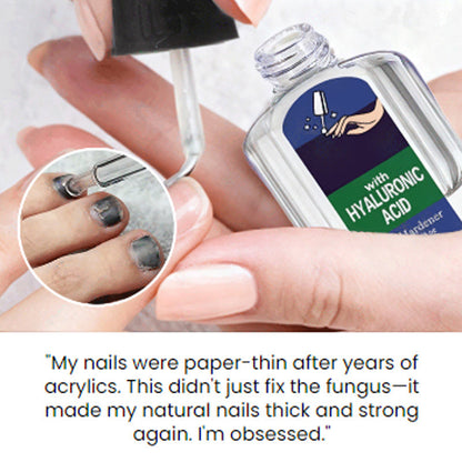 Jemný a účinný prírodný prípravok na starostlivosť o nechty