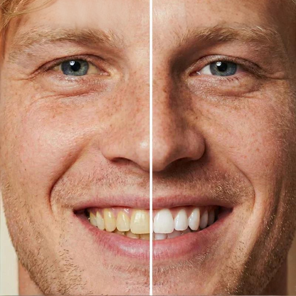 ✨ Okamžitá bieliaca zubná pasta — Výsledky sú viditeľné okamžite! 5 ml balenie, dlhá trvanlivosť! 😁🦷